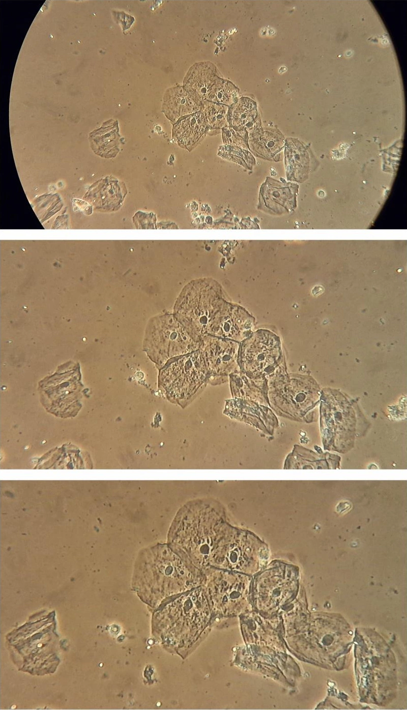 图 10:装置在Leica 教学显微镜─Leitz HM Lux 3 的相机所拍摄出的影像,物镜:Phaco L 32/0 40, 目镜: Periplan GF 10x/18(可供配戴眼镜者使用)。湿型上皮细胞的幻灯片,相位对比,简单的环形环创建影像(没有Köhler照明)。照片不缩放(上图),缩放3倍(中图),缩放4倍(下图)。