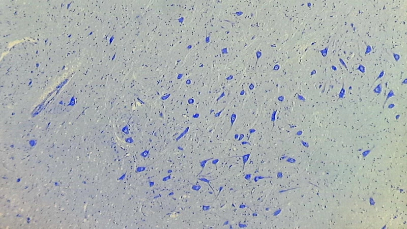 Fig. 9. Image from camera with included eyepiece (manufacturer: Meiji) used with Leica stereo microscope M 80. Specimen from Figs. 7 and 8, bright-field.