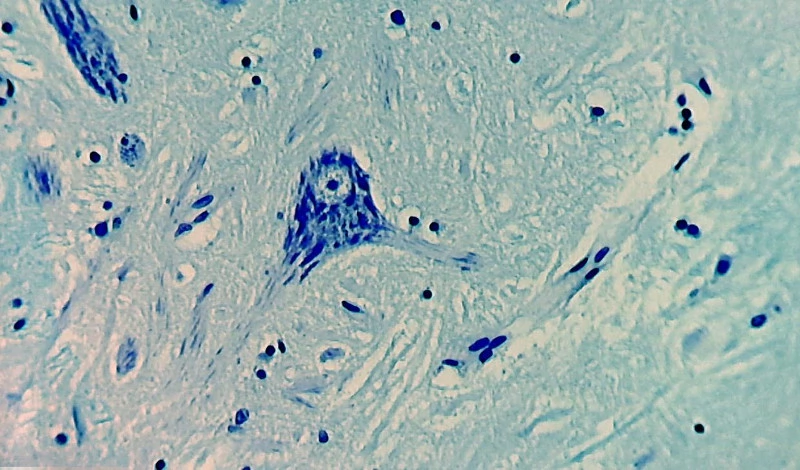 Fig. 8. Specimen and equipment as in Fig. 7, moderately zoomed micrograph without vignetting, edge blur can still be seen on the left and right edges of the image.