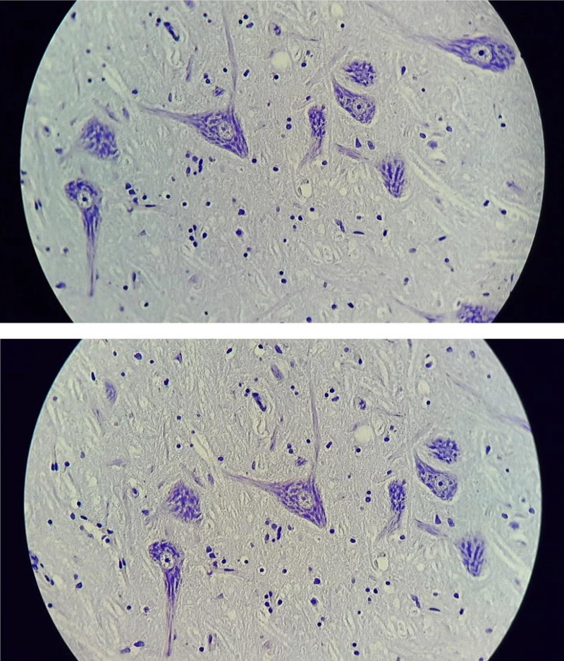 Fig. 11. Comparison of eyepieces, nerve cells (same slide used in Fig. 7-9), microscope: Leica DMLB, camera with Meiji eyepiece 10x (above), camera body placed manually on the original Leica eyepiece 10x (below), perceptible visual superiority of the Leica eyepiece (edge focus, contour focus, contrast).